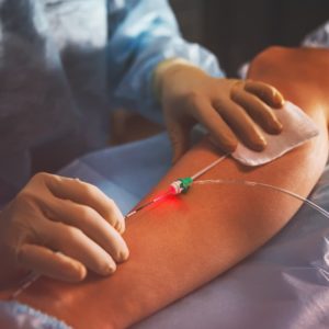 Laser Endovenoso